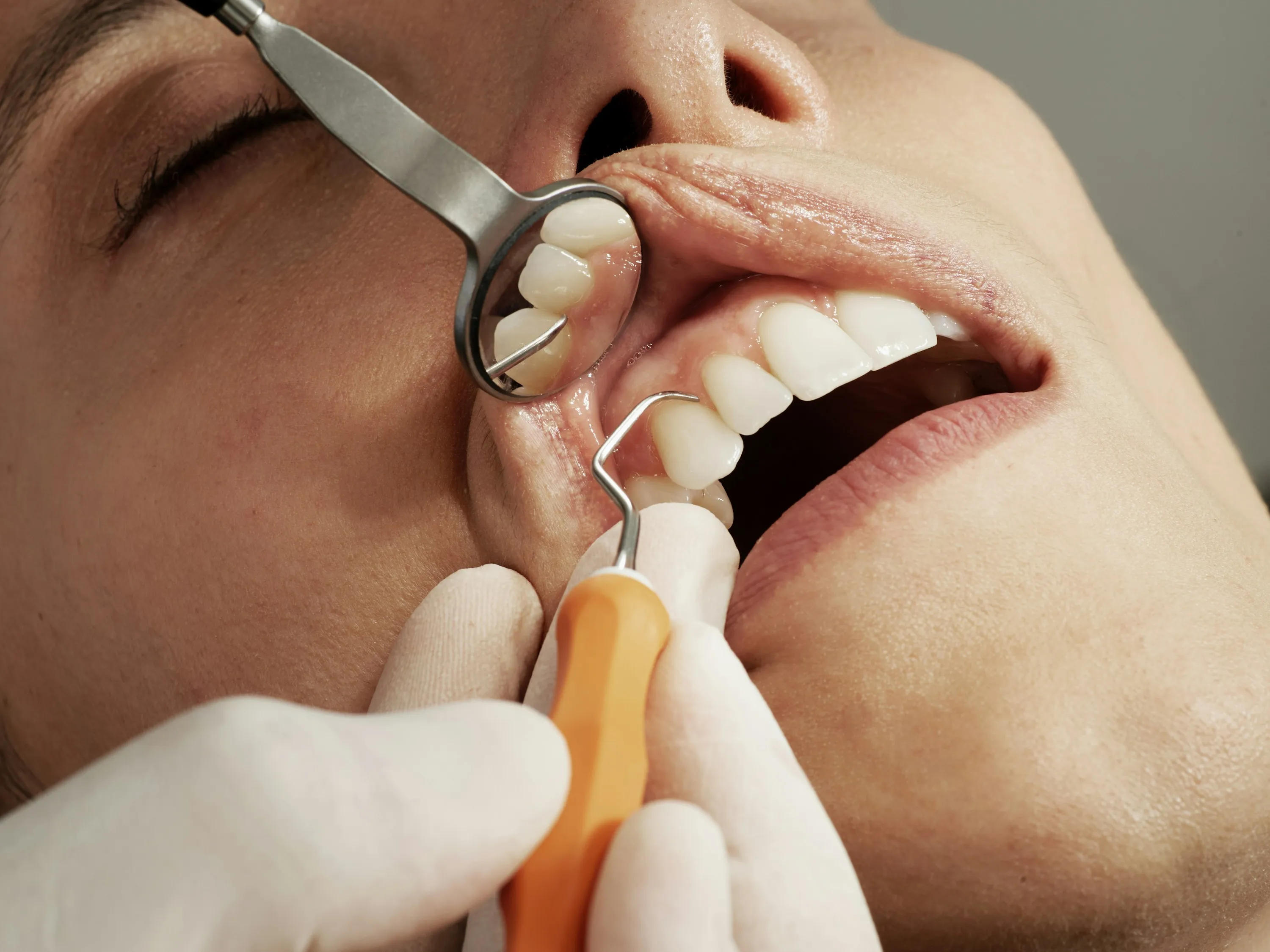 Close-up periodontal examination using a dental mirror and probe